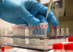 First-of-its-Kind Blood Test Can Detect Over 50 Kinds of Cancer—Often Before Symptoms Even Show First-of-its-Kind Blood Test Can Detect Over 50 Kinds of Cancer—Often Before Symptoms Even Show