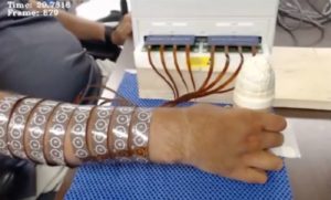 Researchers Restore Injured Man’s Sense of Touch Using Ingenious Brain-Computer Interface