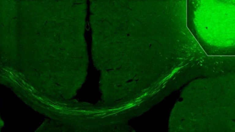 Neurobiologists Actually Managed to Reverse Stroke Damage Using Human Skin Cells